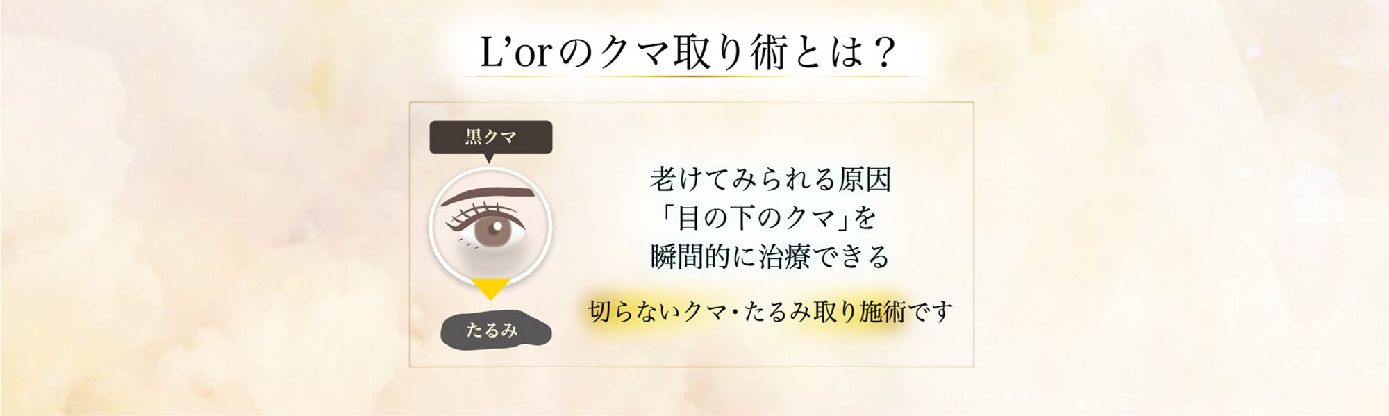 L'orのクマ取り術とは？切らないクマ・たるみ取り施術です