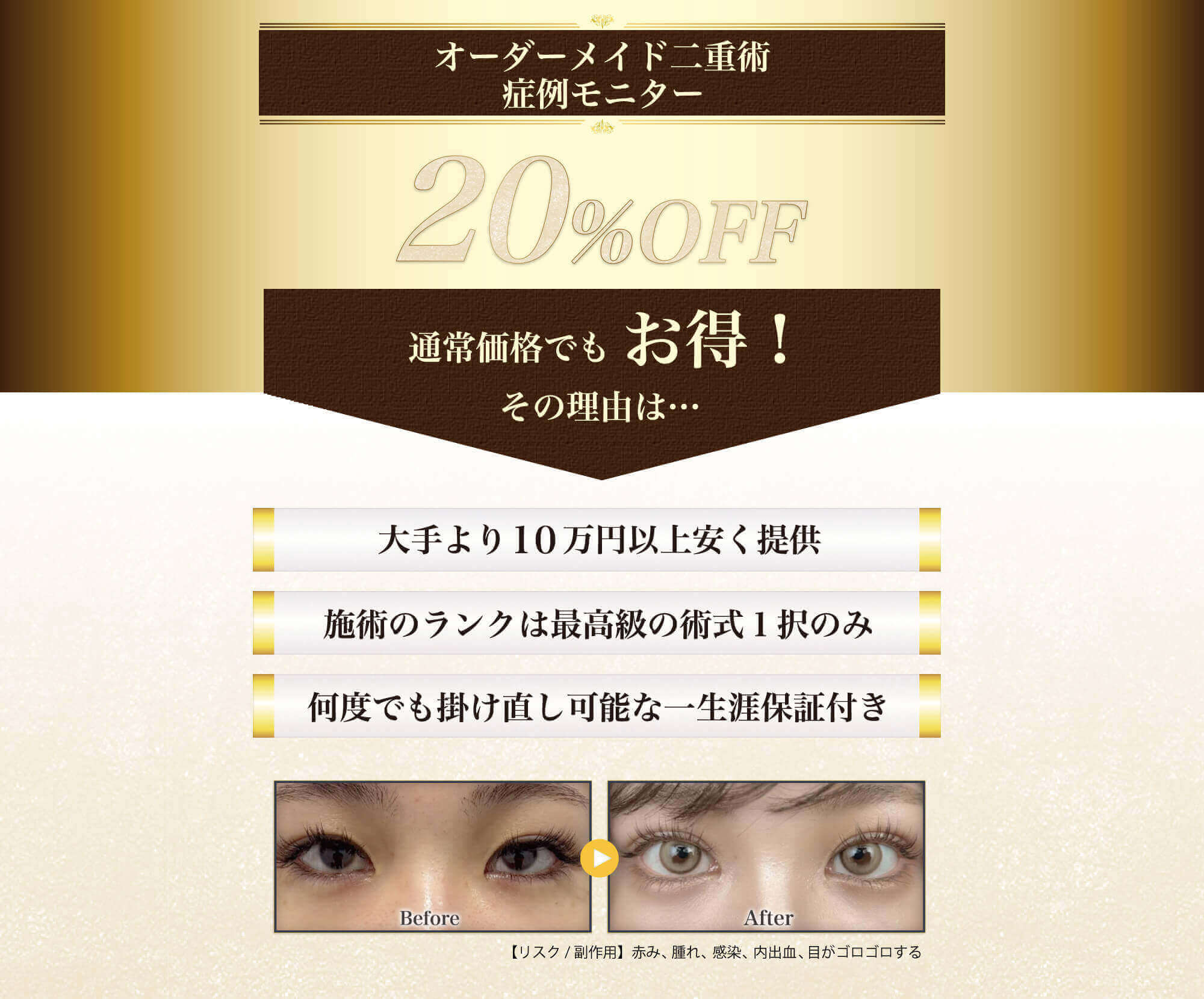 症例モニター20%OFF