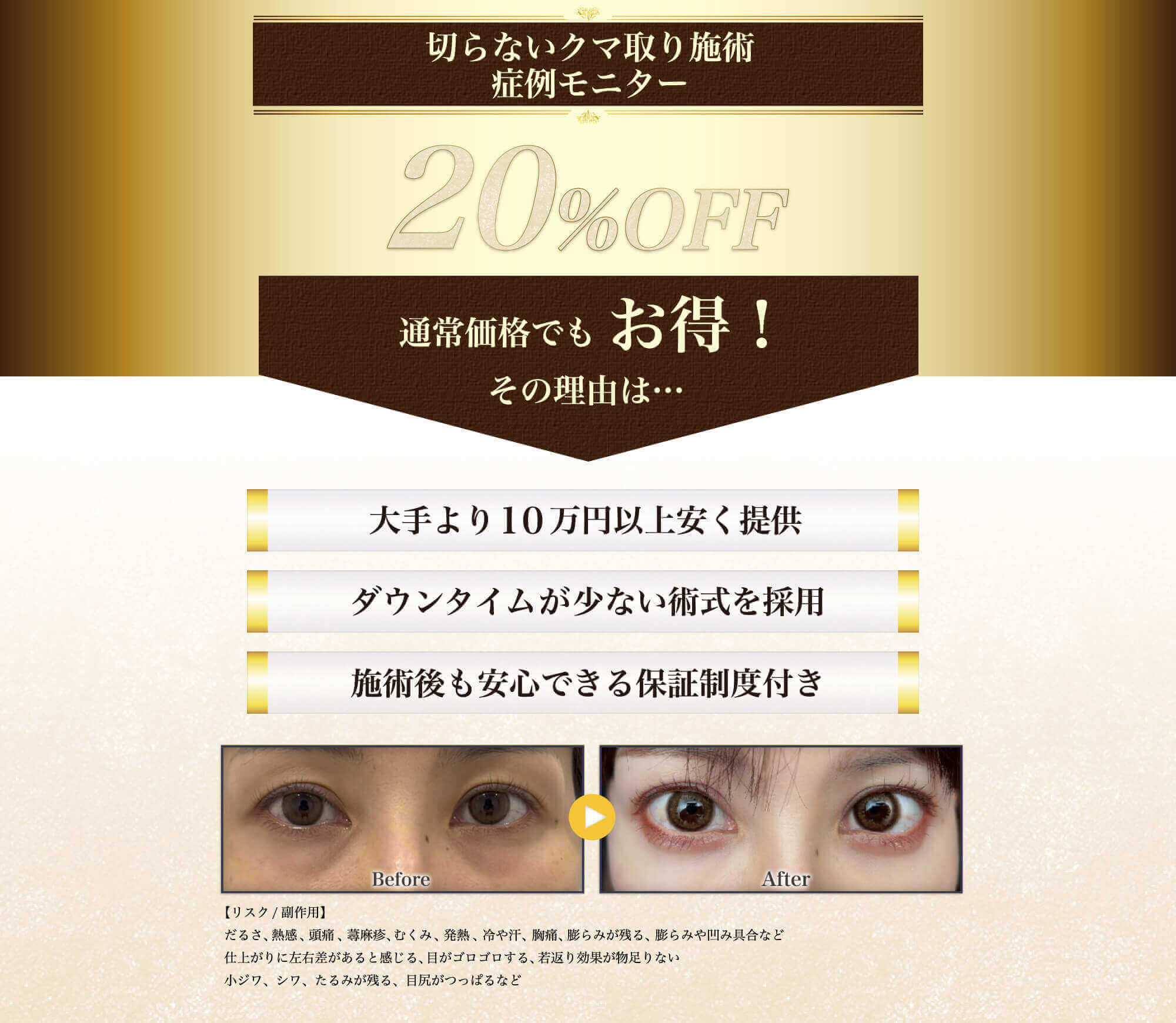 症例モニター20%OFF