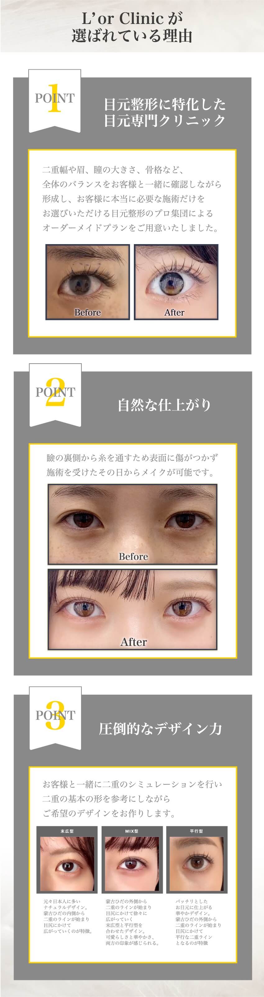 L'orが選ばれている理由