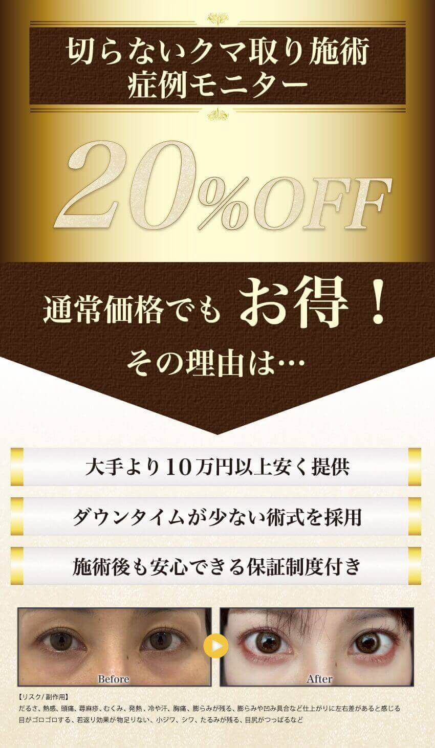 症例モニター20%OFF