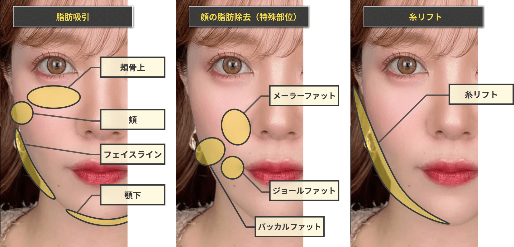 各施術のメリット