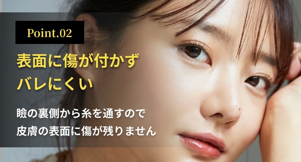 表面に傷が付かずバレにくい：瞼の裏側から糸を通すので皮膚の表面に傷が残りません