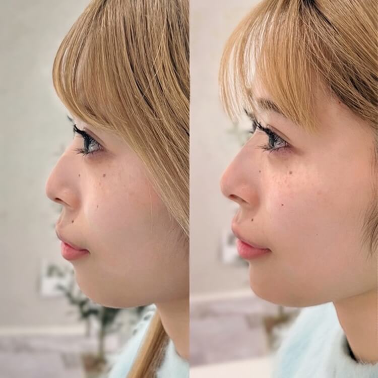 症例