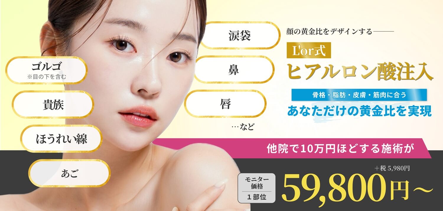 L'or式ヒアルロン酸注入－涙袋、ゴルゴ（※目の下を含む）、鼻、貴族、ほうれい線、唇、あご、など。他院で10万円ほどする施術がモニター価格（1部位）59,800円(＋税5,980円)