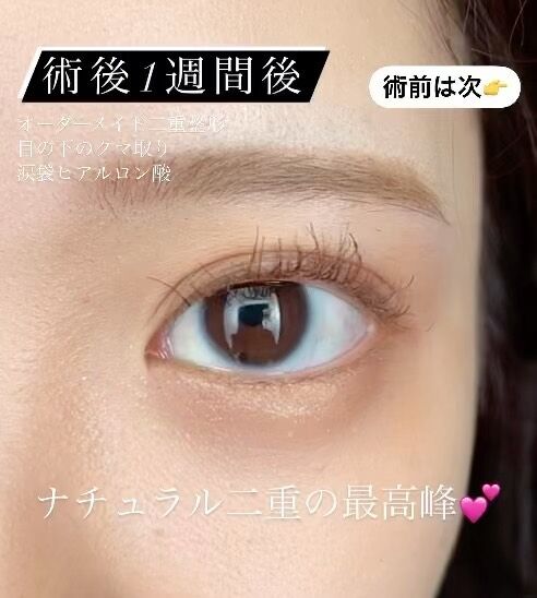 二重 目元 L Or Clinic Omotesando