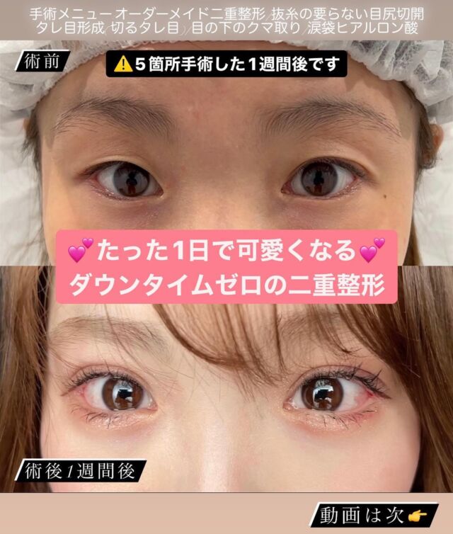 二重 目元 L Or Clinic Omotesando